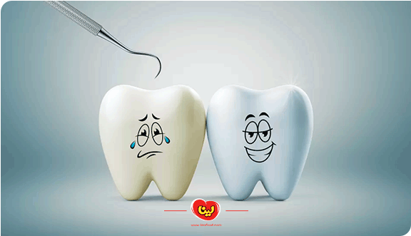 مراقبت از دندان بعد از خوردن پفک