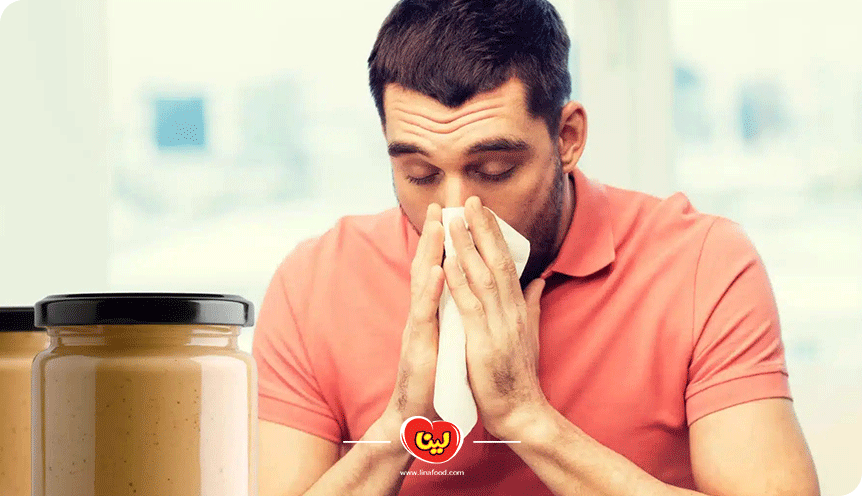 حساسیت به کره بادام زمینی