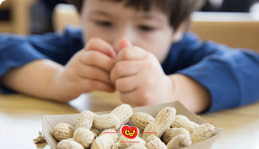 آلرژی به کره بادام زمینی